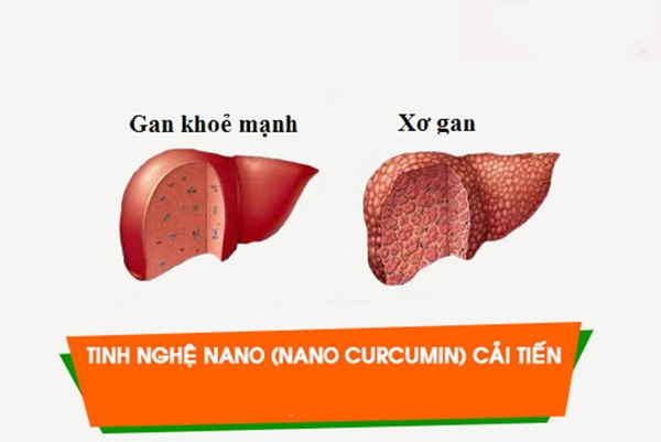 Sử dụng nano curcumin tam thất xạ đen đúng cách, hiệu quả cao